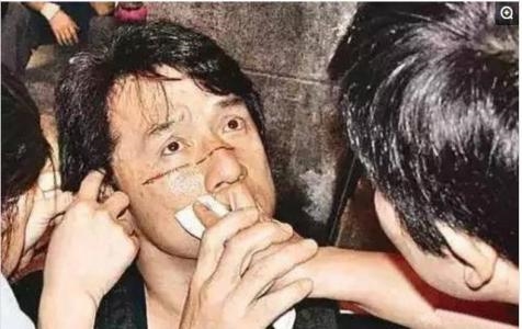 Những ngôi sao hành động Hoa ngữ gặp tai nạn trường quay nghiêm trọng