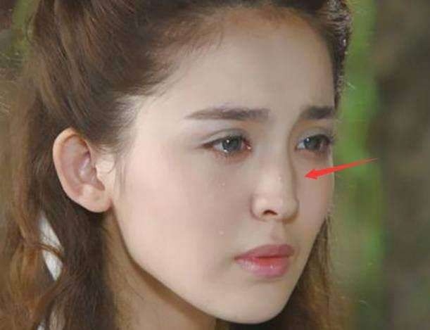 Trịnh Sảng và Cổ Lực Na Trát phẫu thuật thẩm mỹ