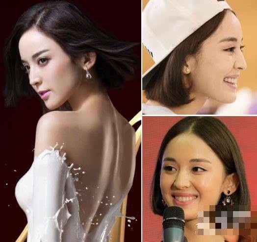 Trịnh Sảng và Cổ Lực Na Trát phẫu thuật thẩm mỹ