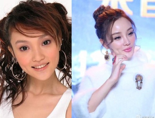 Lý Tiểu Lộ gọt mặt quá đà, cằm nhọn hoắt như thẩm mỹ hỏng