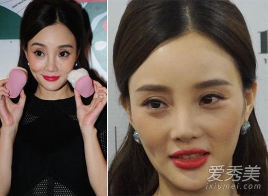 Lý Tiểu Lộ gọt mặt quá đà, cằm nhọn hoắt như thẩm mỹ hỏng