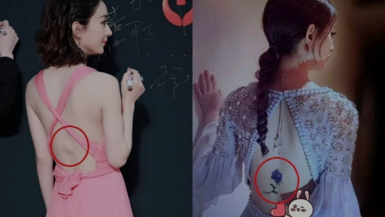 Triệu Lệ Dĩnh khiến fan lo sốt vó vì bị suy tim, tắc nghẽn mạch máu