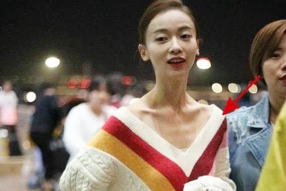 AngelaBaby, Dương Mịch... và mỹ nhân Cbiz gầy đáng báo động