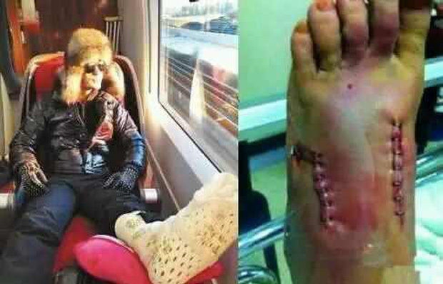 Triệu Lệ Dĩnh và những ngôi sao từng gặp tai nạn trên phim trường