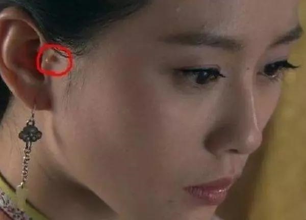 Những khuyết điểm mà Tôn Lệ, Dương Mịch và mỹ nhân Cbiz muốn che giấu