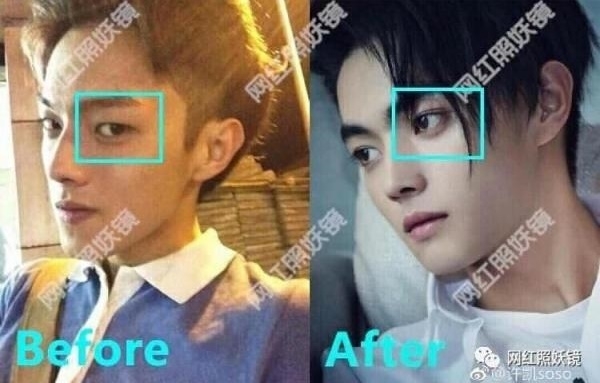 Hứa Khải, Trương Bân Bân và dàn mỹ nam Cbiz có nhan sắc khác xưa nhiều