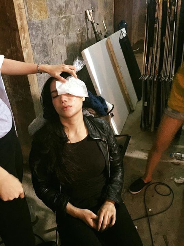 Ngô Thanh Vân, Lan Ngọc và những mỹ nhân Việt gặp tai nạn ở phim trờng
