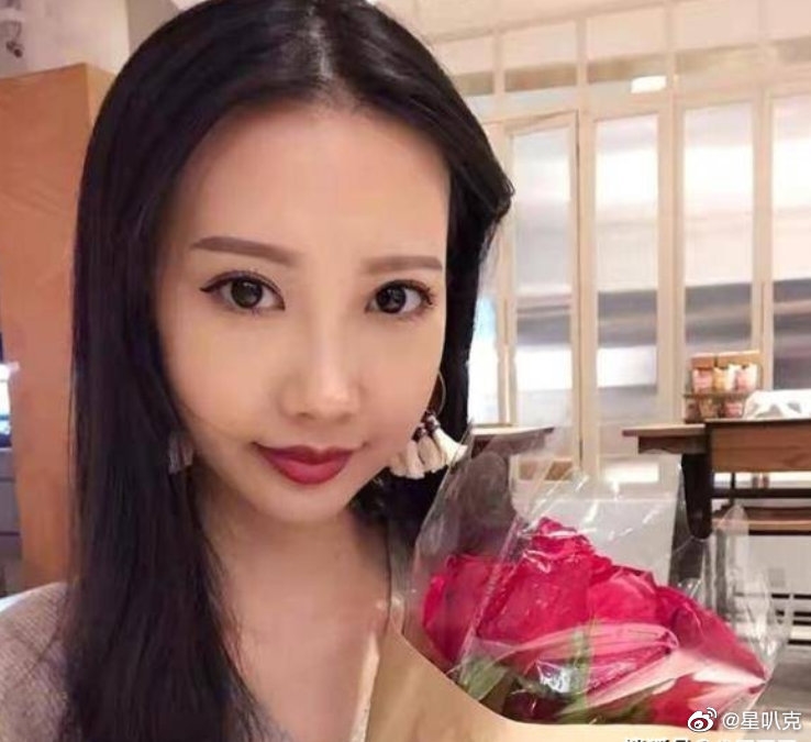 Nữ diễn viên Hồng Kông mắc bệnh hiểm nghèo khiến gương mặt biến dạng