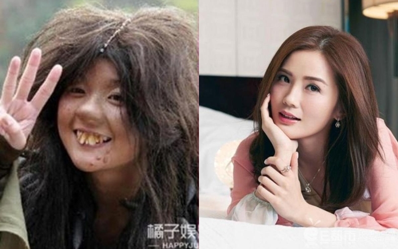 Trương Bá Chi, Mạc Văn Úy và dàn mỹ nhân với hàm răng gập ghềnh