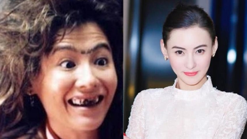 Trương Bá Chi, Mạc Văn Úy và dàn mỹ nhân với hàm răng gập ghềnh
