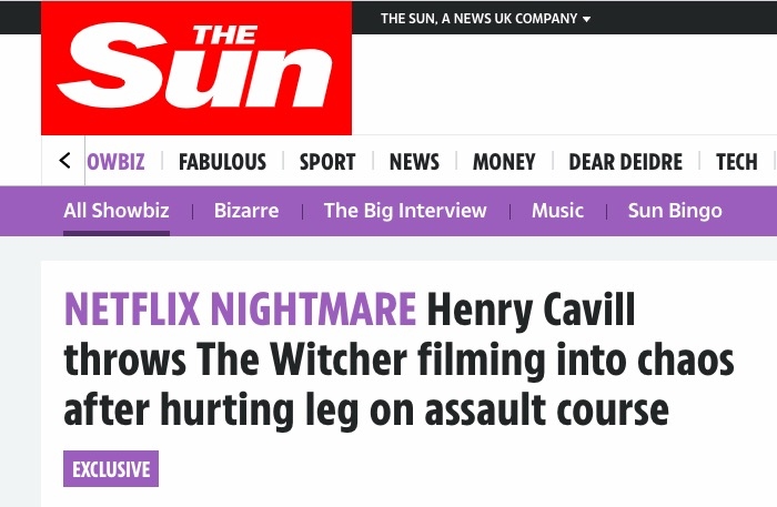 Henry Cavill gặp tai nạn khiến fan lo lắng