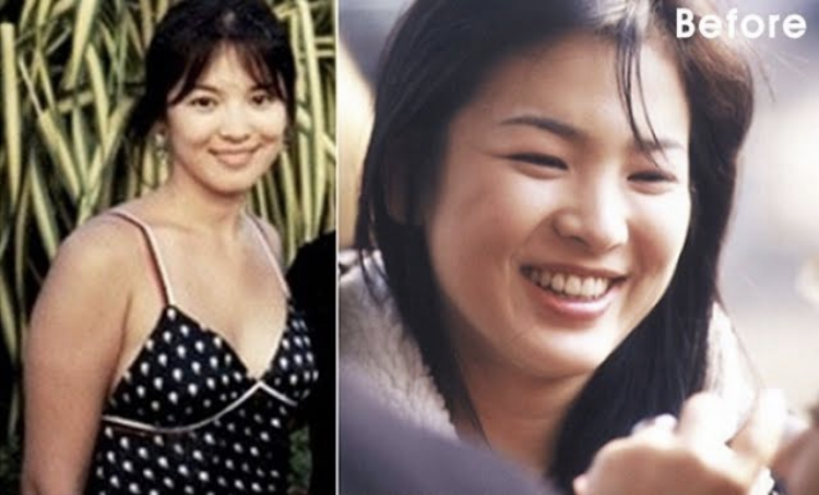 Song Hye Kyo, Suzy cùng dàn diễn viên 'lột xác' nhờ giảm cân
