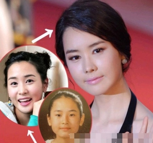 Yoon Eun Hye và mỹ nữ Hàn nghiện sửa sang nhan sắc