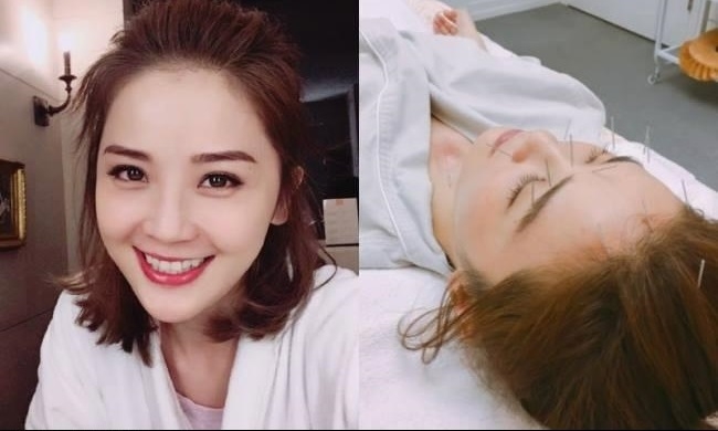 Thái Thiếu Phân và dàn mỹ nhân Cbiz châm cứu mặt để làm đẹp